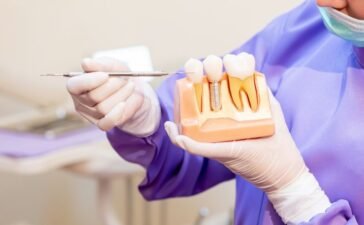 implanty zębów Katowice